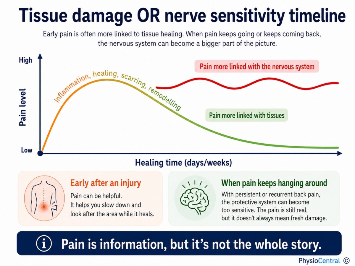 Infographic showing how pain can change over time, with early pain more linked to tissue healing and ongoing or recurrent back pain becoming more linked to the nervous system.