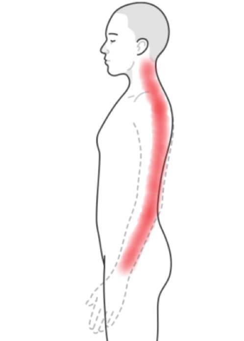 neck pain into arm