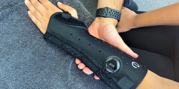 EXOS casts for fractured wrists and forearms